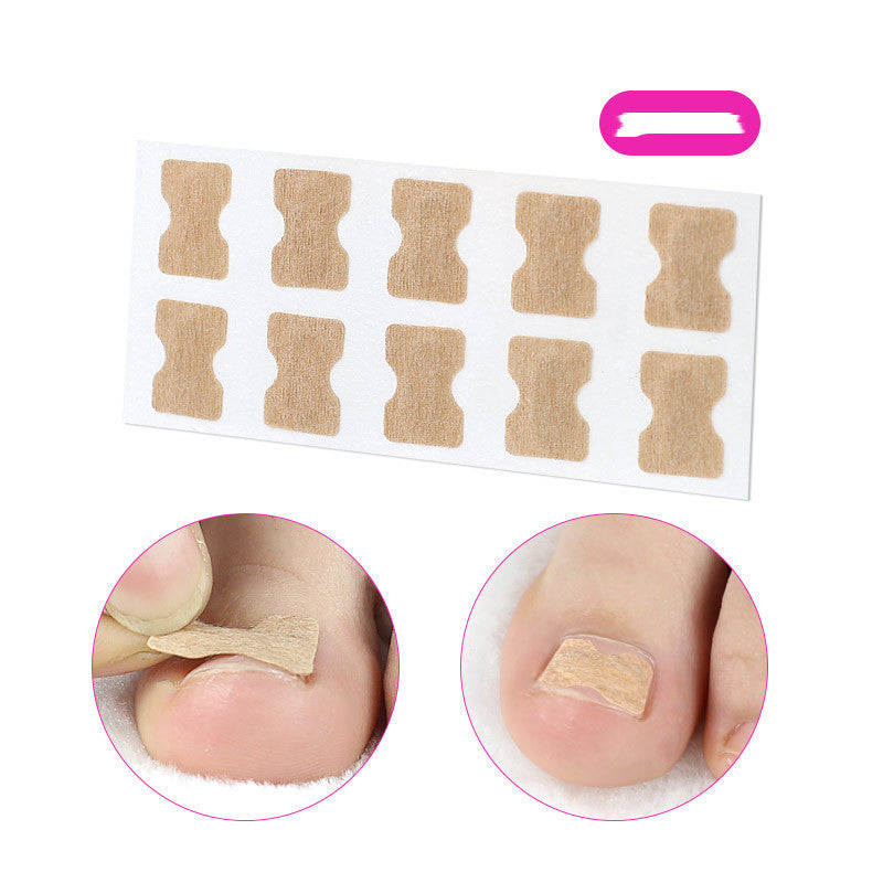 Klebstofffreies orthopädisches Nagelfixationsgerät