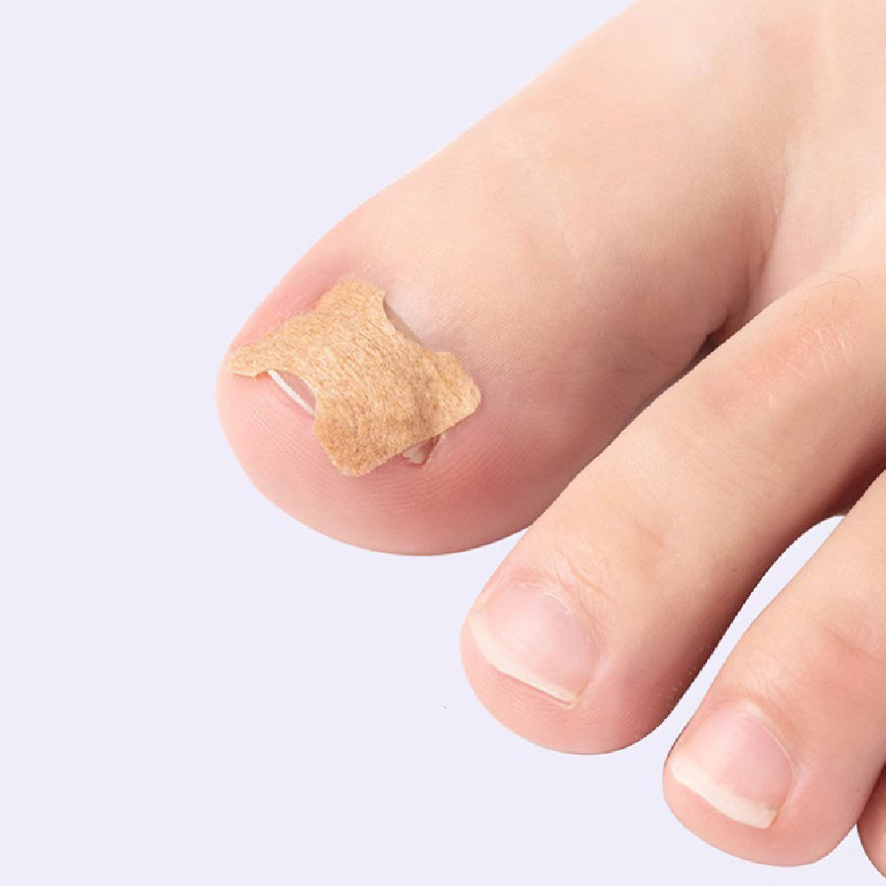 Toe Glue-free Toenail Straightening Sticker